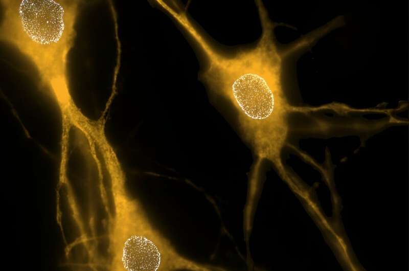 Study reveals how key protein affects neuron structure