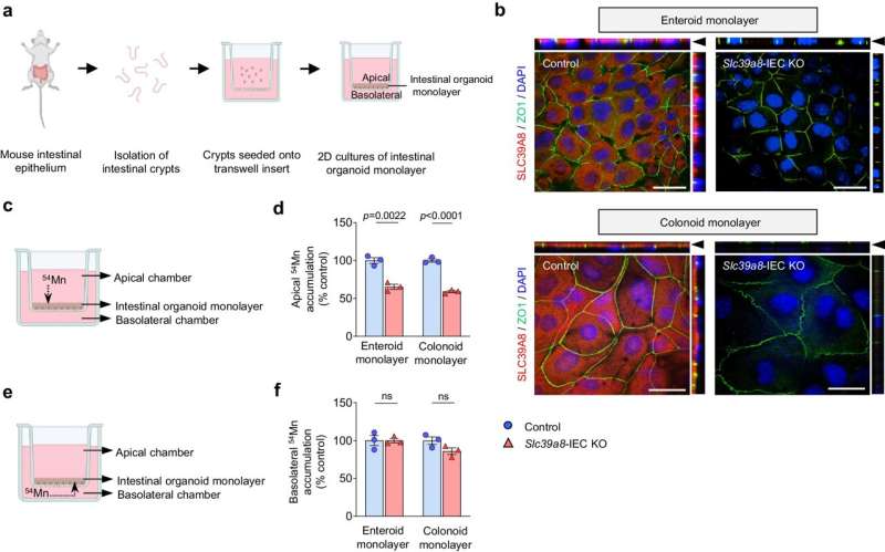 Gut reaction: Low levels of manganese can aggravate inflammatory bowel disease