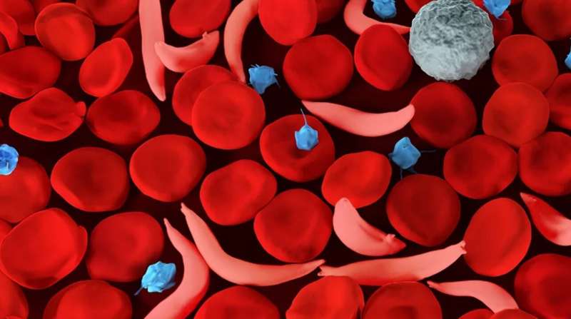 Genetic carriers for sickle cell disease have higher risks of blood clots across diverse ancestries