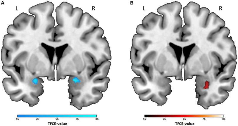 Imaging study shows what your favorite film genres reveal about your brain