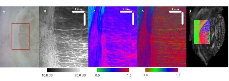 Integrating MRI and OCT for new insights into brain microstructure