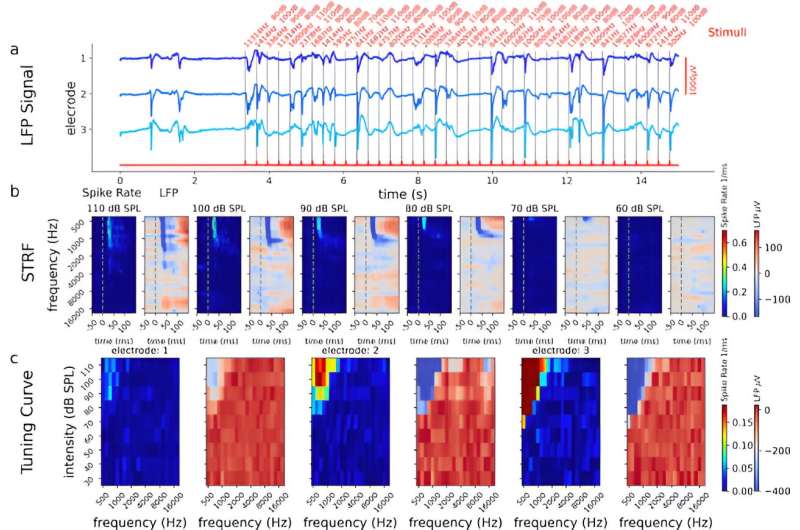 AI reveals new insights into human brain activity