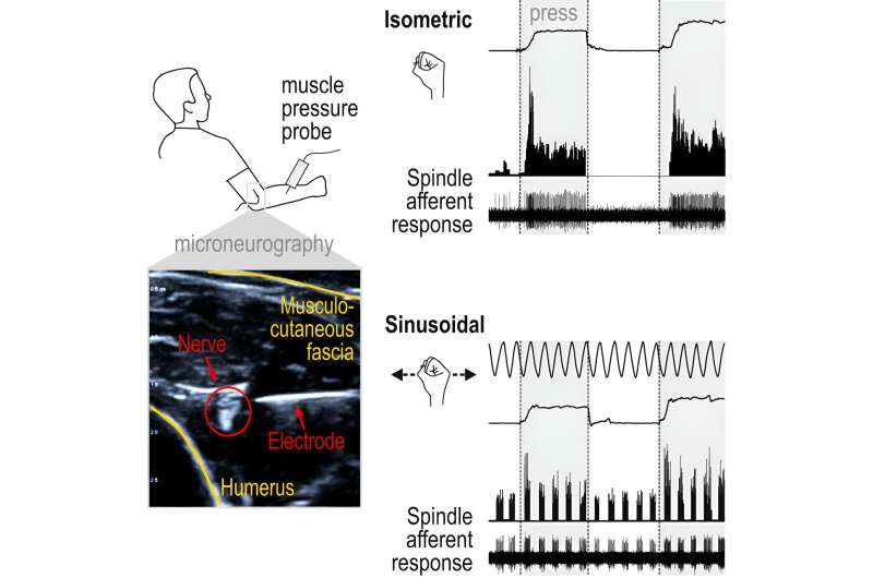 Pressure sensing by muscles provides a promising new target for treatments