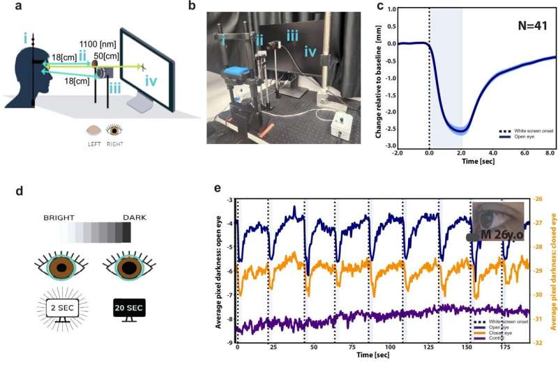 Closed-eye imaging can track wakefulness, awareness and pain in unresponsive conditions