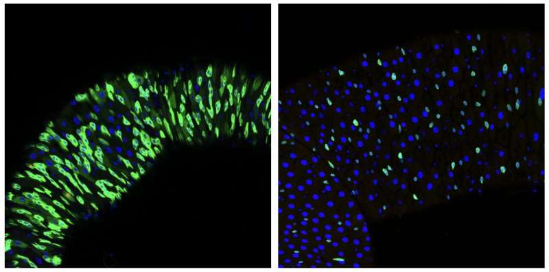 How aging affects stem cells: A fly's tale