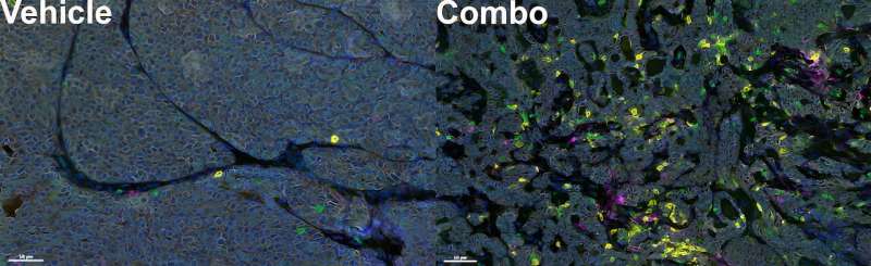 Double trouble for triple-negative breast cancer