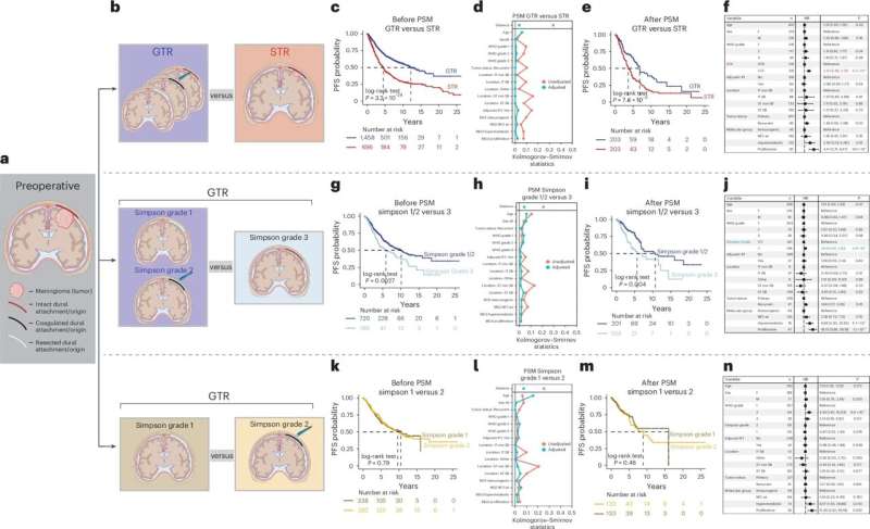 Molecular profiling may improve meningioma decision making