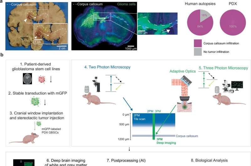 Researchers customize top-of-the-line microscopy method with AI to better understand glioblastoma tumors