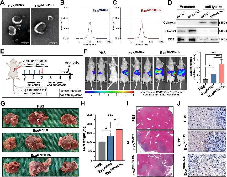 Critical Review of the Role of Exosomal miR-519a-3p in Gastric Cancer Liver Metastasis through M2 Macrophage Polarization 