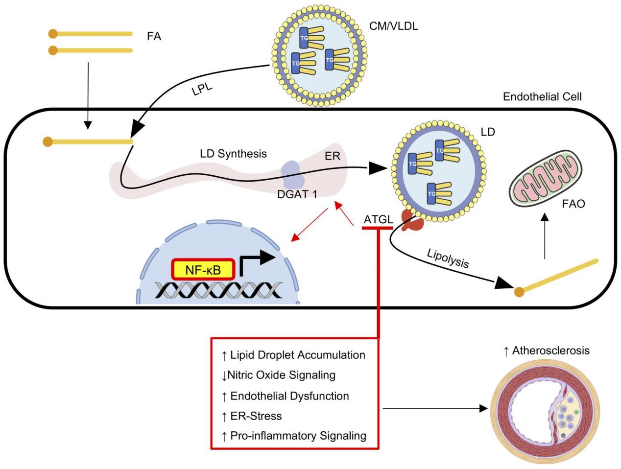 Metabolic remodeling in endothelial cells and macrophages contributes to plaque instability and vulnerability 