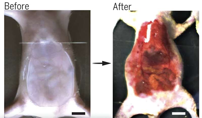 Scientists have figured out how to see through mice—could humans be next?