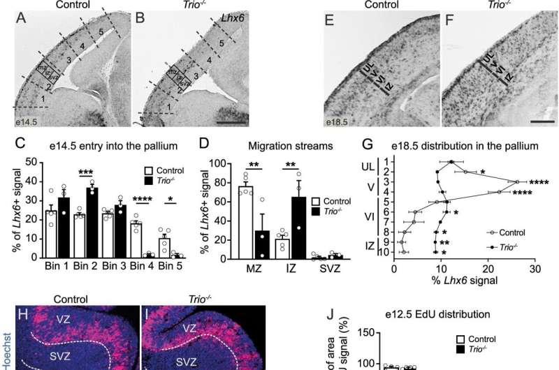 Study reveals key role of TRIO gene in epileptic encephalopathies