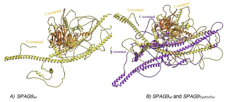 Study unveils new genetic syndrome linking brain development and neurodegeneration