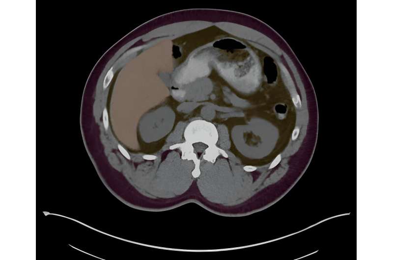 AI-guided imaging system improves radiology precision