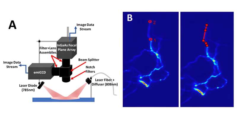 New technique improves imaging for lymphatic system