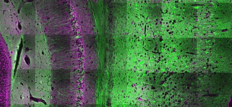 Brain molecule makes neurons less selective, deepening understanding of human cognition