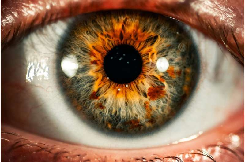 eye