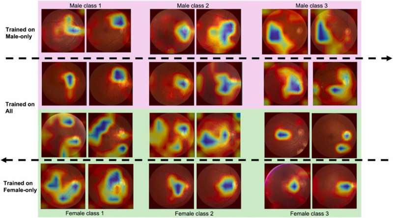 Leveraging AI to analyze retinal images for cardiovascular risk assessment