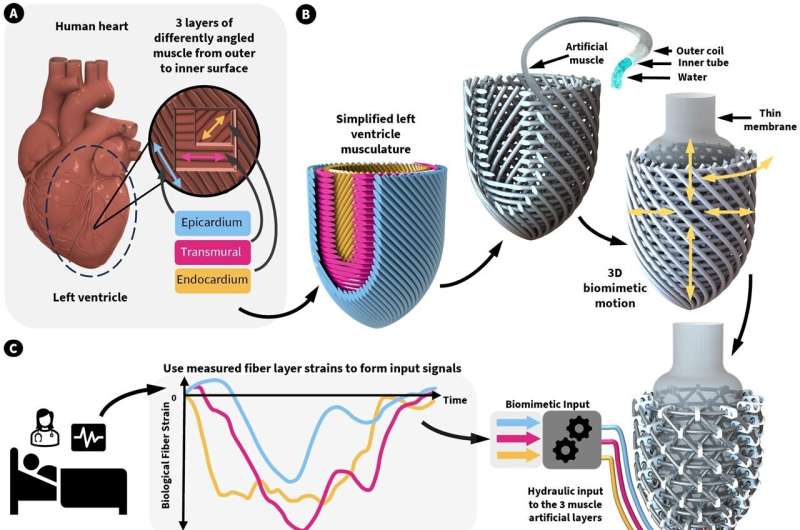 Artificial left ventricle mimics the shape and function of the human heart