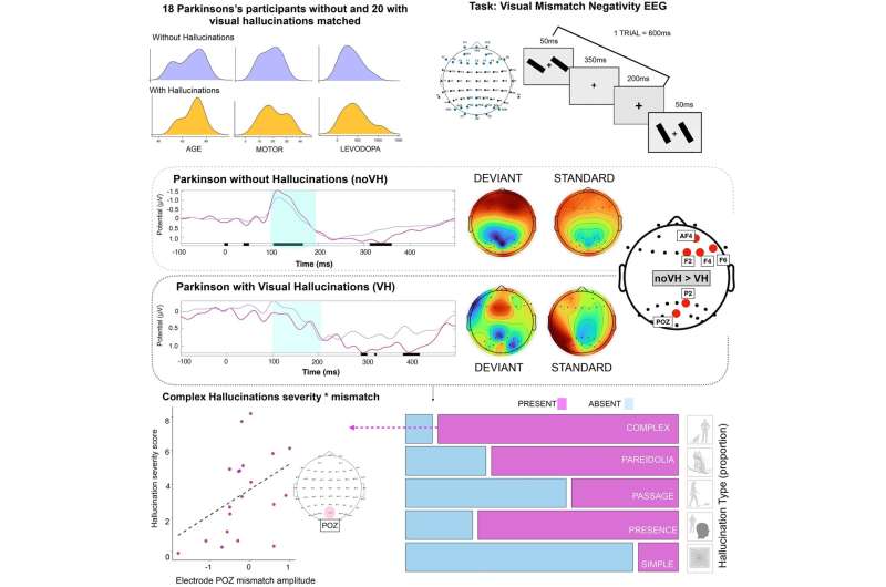 Visual mismatch negativity identified as a mechanism of Parkinson's disease psychosis