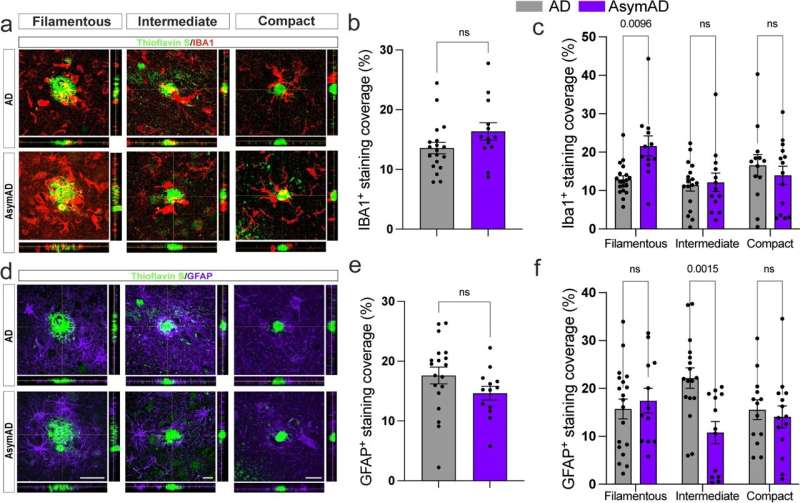 Key mechanisms in asymptomatic Alzheimer's disease brains offer potential protection against cognitive decline