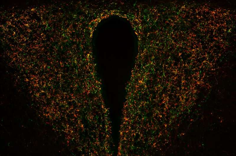 Diabetes risk: fat alone does not cause changes in the hypothalamus