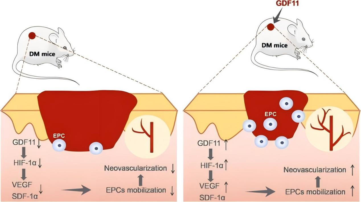 GDF11 stimulates EPC mobilization and neovascularization to promote diabetic wound healing 