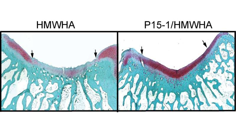 Revolutionizing cartilage repair: The role of macrophages and hyaluronic acid in healing injuries