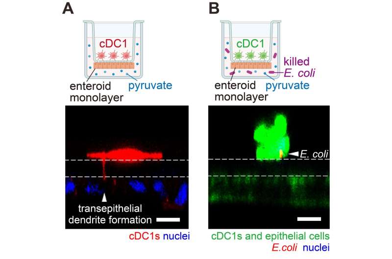 Study reveals how our gut cells detect harmful invaders