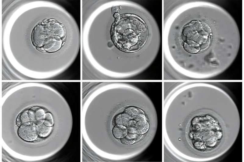 A fully automated AI-based system for assessing IVF embryo quality