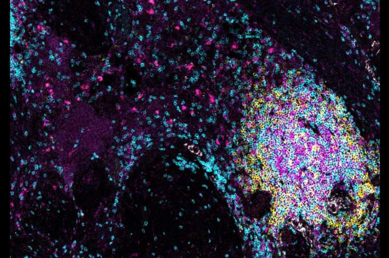 Lymph node-like structures may trigger the demise of cancer tumors