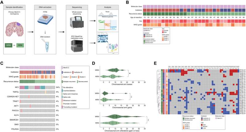 Study increases understanding of what makes multiple recurrent meningiomas the most aggressive form of brain tumor