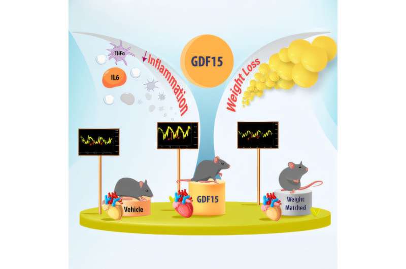 New anti-obesity drug shows promise in preventing heart failure related to type 2 diabetes