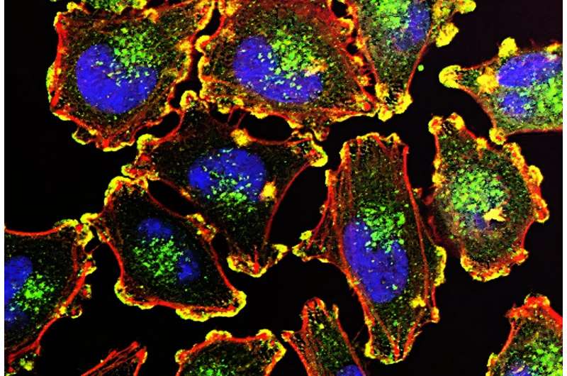 How melanoma cells escape oxidative stress to metastasize