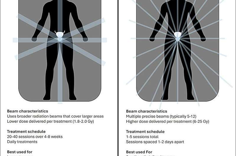 What is stereotactic radiation therapy for prostate cancer? How does it compare to other treatments?