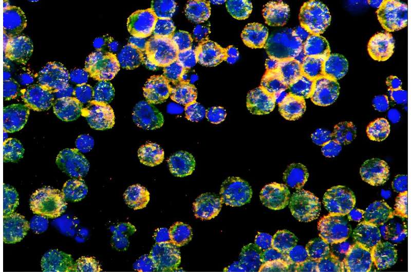 Discovery of new mechanism explains how ovarian cancer disables immune cells