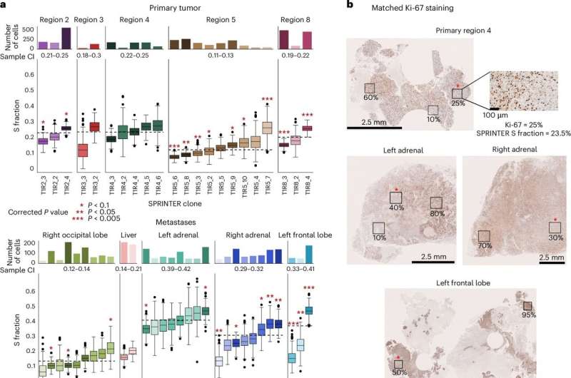 Scientists expose cells driving aggressive tumor growth