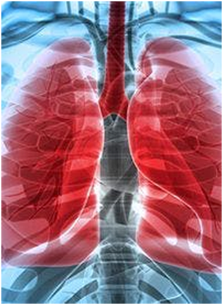 Iflinatamab Deruxtecan Elicits Clinical Activity in SCLC 