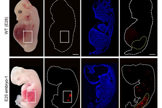 Human kidneys have been partially grown in pigs for the first time