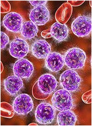 Acalabrutinib Approved in China for Chronic Lymphocytic Leukemia 