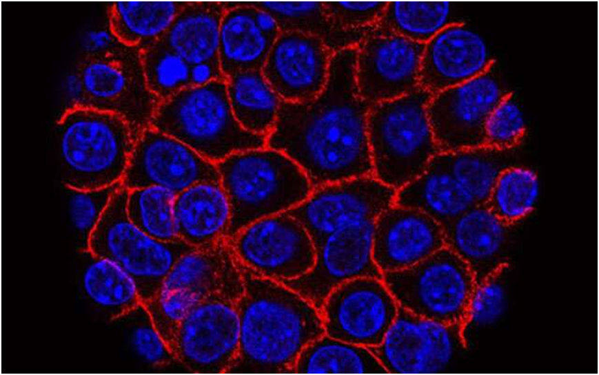 Newfound mechanism suggests drug combination could starve pancreatic cancer 