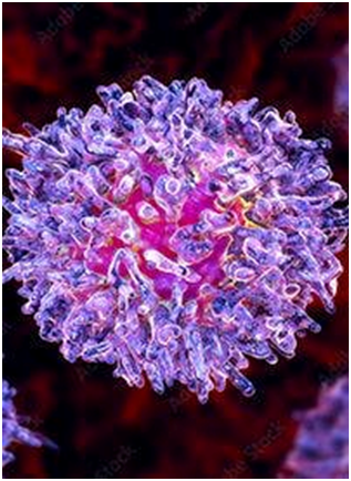 AstraZeneca to Discontinue Moxetumomab Pasudotox in US for Hairy Cell Leukemia 