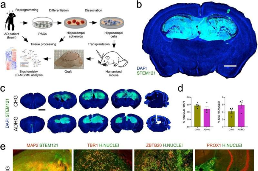 New model leverages stem cells to provide window into Alzheimer's disease development