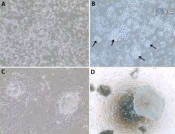 Novel technique to produce stem cells from peripheral blood 