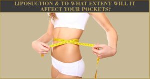 Liposuction-To-What-Extent-Will-It-Affect-Your-Pockets-300x158