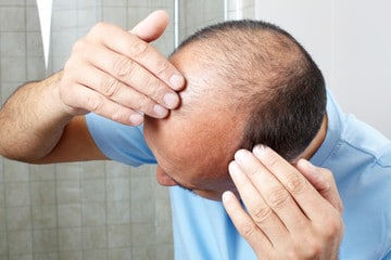 Impact of Enzymes and Treatment on hair loss 