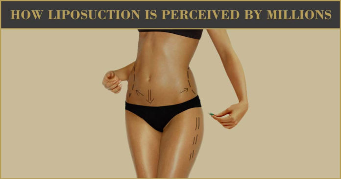 How-Liposuction-Is-Perceived-By-Millions-696x365