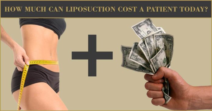 How-Much-Can-Liposuction-Cost-A-Patient-Today-696x365