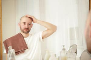 Causes of Hair Loss and Advisable Food for Hair Growth 