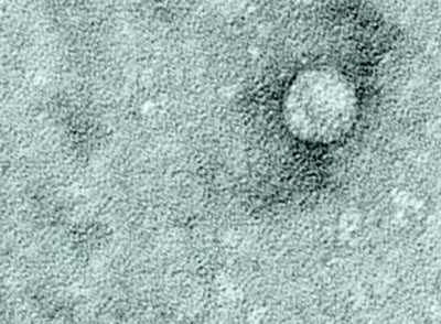 An image of hepatitis C